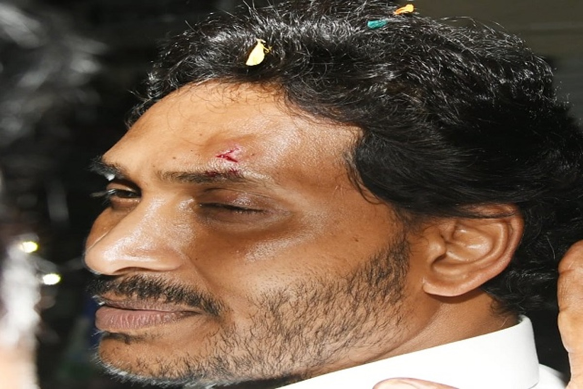 AP CM Jagan Mohan Reddy hurt in stone pelting : آندھرا پردیش کے وزیر اعلی جگن موہن ریڈی پر روڈ شو کے دوران پتھراؤ، پیشانی پر لگی چوٹ