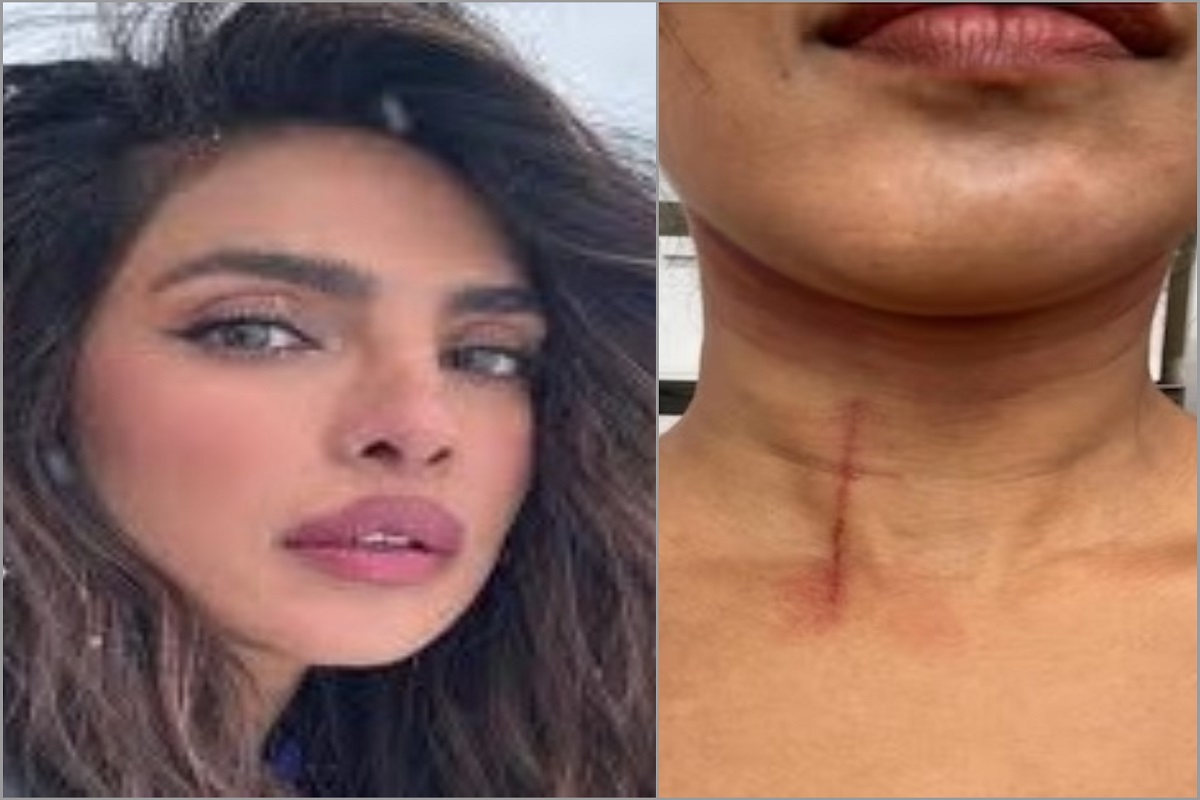 Priyanka Chopra Injured: شوٹنگ کے دوران زخمی ہوئیں پرینکا چوپڑا، اسٹنٹ کرنے میں گردن میں لگی چوٹ، اداکارہ نے شیئرکی تصویر
