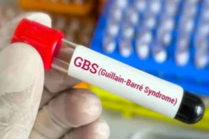 CoVID-19 کے بعد اب Guillain-Barre syndrome کا قہر، 11اموات، 193 مریضوں کی تصدیق